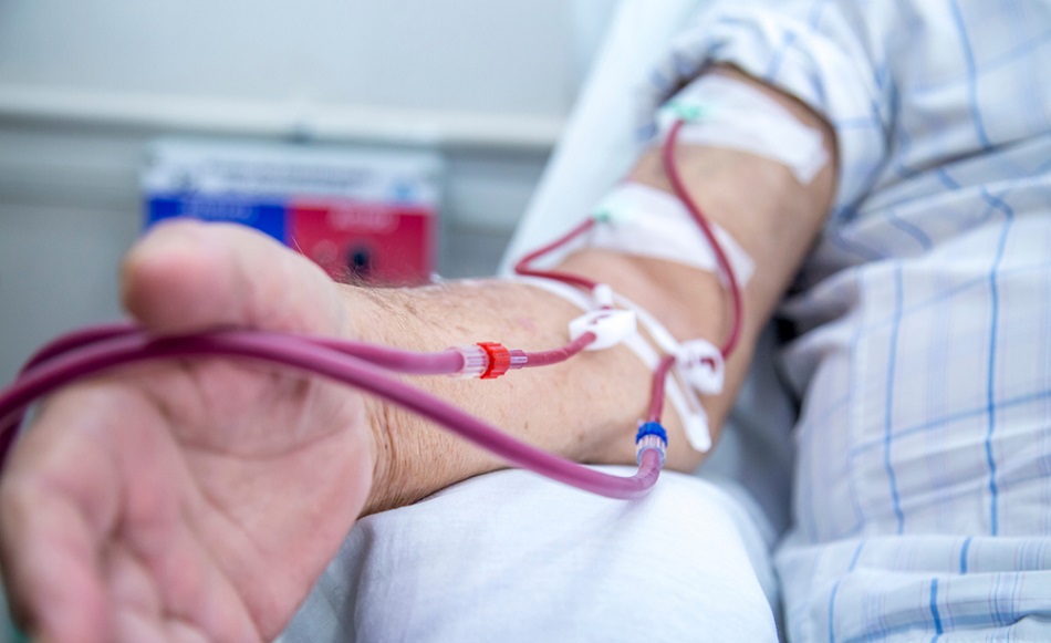 AV ghép - Đây là giải pháp thay thế khi mạch máu của bệnh nhân quá nhỏ