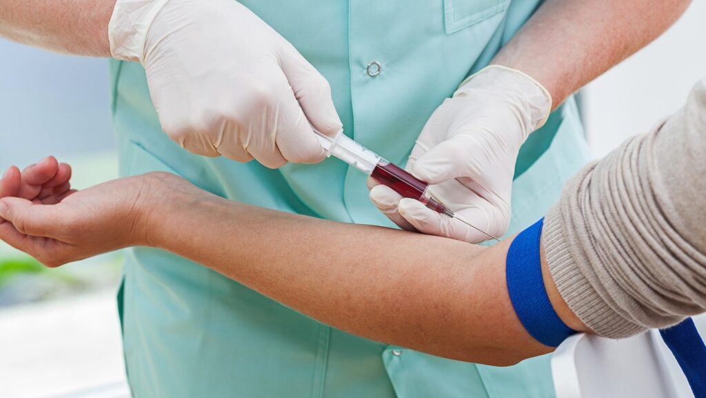 Kiểm tra máu hoặc nước tiểu để chẩn đoán bệnh thận