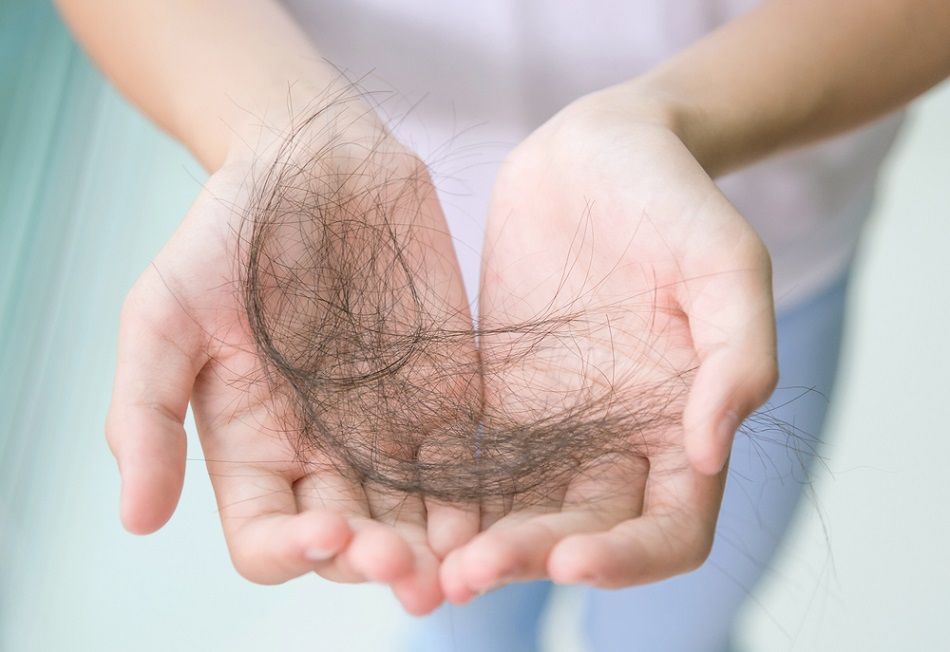 Rụng tóc là dấu hiệu cho thấy cơ thể đang bị thiếu máu thiếu sắt 