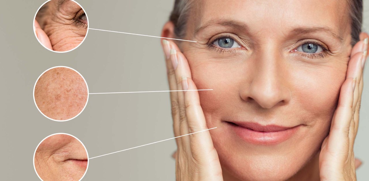 Khi thấy cơ thể xuất hiện các dấu hiệu lão hóa thì nên bổ sung Collagen