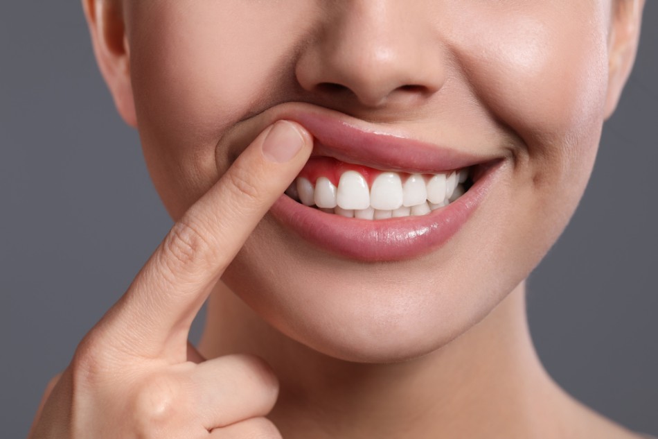 Ăn hạt sen tốt cho những người đang gặp vấn đề về răng và nướu